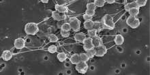 methanogen_Thumbnail.jpg